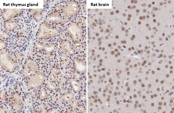 53BP1 antibody [HL275] detects 53BP1 protein by immunohistochemical analysis.</br>Sample: Paraffin-embedded rat tissues.</br>53BP1 stained by 53BP1 antibody [HL275] (GTX635479) diluted at 1:100.</br>Antigen Retrieval: Citrate buffer, pH 6.0, 15 min