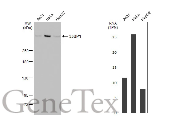 Various whole cell extracts (30 μg) were separated by 5% SDS-PAGE, and the membrane was blotted with 53BP1 antibody [HL275] (GTX635479) diluted at 1:1000. The HRP-conjugated anti-rabbit IgG antibody (GTX213110-01) was used to detect the primary antibody. Corresponding RNA expression data for the same cell lines are based on Human Protein Atlas program.
