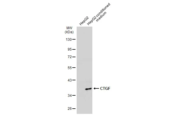 CTGF antibody [GT7812]