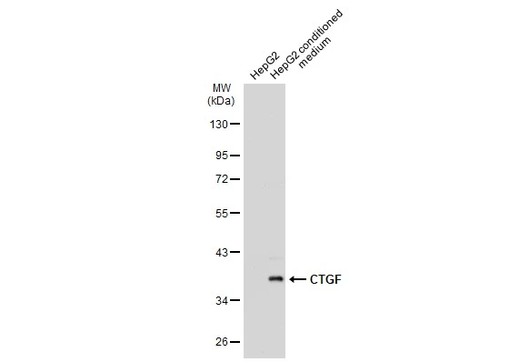 CTGF antibody [GT8610]
