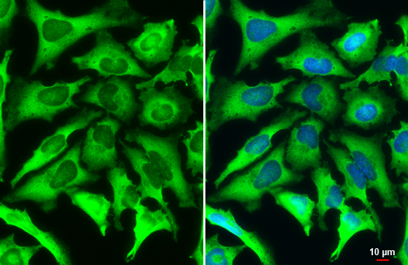 FACL4 antibody [HL229] detects FACL4 protein at cytoplasm by immunofluorescent analysis. Sample: HeLa cells were fixed in 4% paraformaldehyde at RT for 15 min. Green: FACL4 stained by FACL4 antibody [HL229] (GTX635616) diluted at 1:500. Blue: Fluoroshield with DAPI (GTX30920). Scale bar= 10 μm.