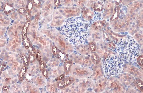 FACL4 antibody [HL229] detects FACL4 protein at cell membrane and cytoplasm by immunohistochemical analysis. Sample: Paraffin-embedded mouse kidney. FACL4 stained by FACL4 antibody [HL229] (GTX635616) diluted at 1:50. Antigen Retrieval: Citrate buffer, pH 6.0, 15 min