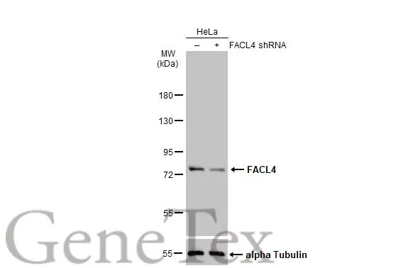 Non-transfected (–) and transfected (+) HeLa whole cell extracts (30 μg) were separated by 7.5% SDS-PAGE, and the membrane was blotted with FACL4 antibody [HL44] (GTX635616) diluted at 1:50000. The HRP-conjugated anti-rabbit IgG antibody (GTX213110-01) was used to detect the primary antibody.