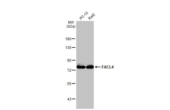 Various whole cell extracts (30 μg) were separated by 7.5% SDS-PAGE, and the membrane was blotted with FACL4 antibody [HL229] (GTX635616) diluted at 1:1000. The HRP-conjugated anti-rabbit IgG antibody (GTX213110-01) was used to detect the primary antibody.