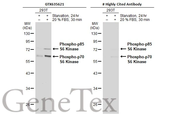 Anti-p70 S6K (phospho Thr421/Ser424) antibody [HL129 Anti-p70 S6K (phospho Thr421/Ser424) antibody [HL129