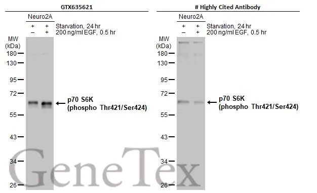 Anti-p70 S6K (phospho Thr421/Ser424) antibody [HL129