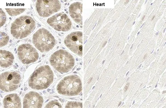 Anti-p70 S6K (phospho Thr421/Ser424) antibody [HL129 Anti-p70 S6K (phospho Thr421/Ser424) antibody [HL129