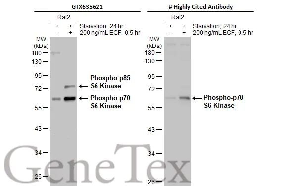 Anti-p70 S6K (phospho Thr421/Ser424) antibody [HL129