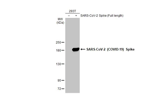 Anti-SARS-CoV-2 (COVID-19) Spike S1 antibody [HL6