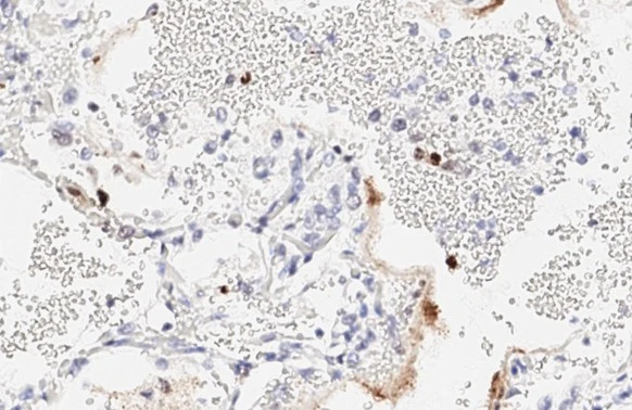 Anti-SARS-CoV-2 (COVID-19) Nucleocapsid antibody [HL448