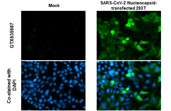 SARS-CoV-2 (COVID-19) nucleocapsid antibody [HL453] detects SARS-CoV-2 (COVID-19) nucleocapsid protein by immunofluorescent analysis. Sample: Mock and transfected 293T cells were fixed in 4% paraformaldehyde at RT for 15 min. Green: SARS-CoV-2 (COVID-19) nucleocapsid stained by SARS-CoV-2 (COVID-19) nucleocapsid antibody [HL453] (GTX635687) diluted at 1:1000. Blue: Fluoroshield with DAPI (GTX30920).
