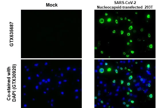 SARS-CoV-2 (COVID-19) nucleocapsid antibody [HL453] detects SARS-CoV-2 (COVID-19) nucleocapsid protein by immunohistochemical analysis. Sample: Mock (GTX435670) and SARS-CoV-2 (COVID-19) Nucleocapsid transfected 293T cell FFPE Cell Pellet Block (GTX435641). Green: SARS-CoV-2 (COVID-19) nucleocapsid stained by SARS-CoV-2 (COVID-19) nucleocapsid antibody [HL453] (GTX635687) diluted at 1:1000. Blue: Fluoroshield with DAPI (GTX30920). Antigen Retrieval: Citrate buffer, pH 6.0, 15 min
