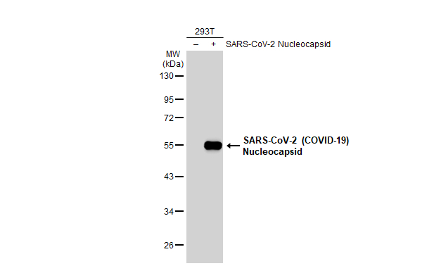Non-transfected (–) and transfected (+) 293T whole cell extracts (30 μg) were separated by 10% SDS-PAGE, and the membrane was blotted with SARS-CoV-2 (COVID-19) nucleocapsid antibody [HL453] (GTX635687) diluted at 1:5000. The HRP-conjugated anti-rabbit IgG antibody (GTX213110-01) was used to detect the primary antibody.