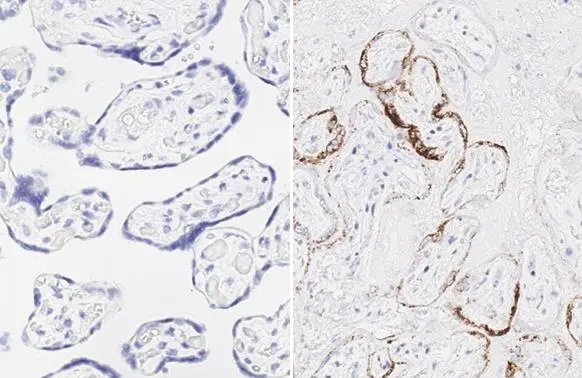 Anti-SARS-CoV-2 (COVID-19) Spike RBD antibody [HL257