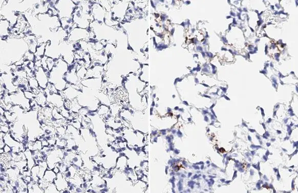 Anti-SARS-CoV-2 (COVID-19) Spike RBD antibody [HL257