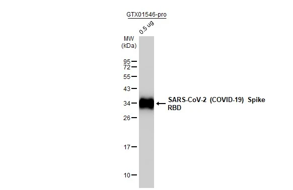 erk様　S Anti-SARS-CoV-2 (COVID-19) Spike RBD antibody [HL257