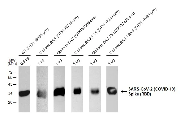 erk様　S Anti-SARS-CoV-2 (COVID-19) Spike RBD antibody [HL257