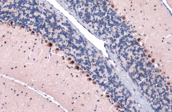 Gli1 antibody [GT249] detects Gli1 protein at nucleus by immunohistochemical analysis. Sample: Paraffin-embedded mouse cerebellum. Gli1 stained by Gli1 antibody [GT249] (GTX635705) diluted at 1:200. Antigen Retrieval: Citrate buffer, pH 6.0, 15 min