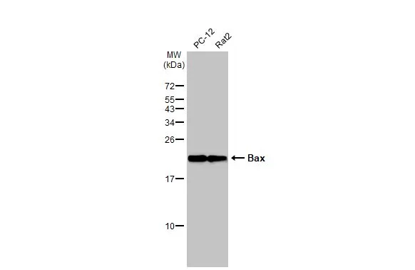 Various whole cell extracts (30 μg) were separated by 15% SDS-PAGE, and the membrane was blotted with Bax antibody [HL236] (GTX635715) diluted at 1:1000. The HRP-conjugated anti-rabbit IgG antibody (GTX213110-01) was used to detect the primary antibody.