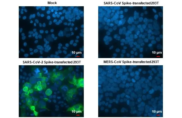 SARS-CoV-2 (COVID-19) Spike RBD antibody [HL1003] detects SARS-CoV-2 (COVID-19) Spike RBD protein at cytoplasm by immunofluorescent analysis.<br>Sample: Mock and transfected 293T cells were fixed in 4% paraformaldehyde at RT for 15 min.<br>Green: SARS-CoV-2 (COVID-19) Spike RBD stained by SARS-CoV-2 (COVID-19) Spike RBD antibody [HL1003] (GTX635792) diluted at 1:2000.<br>Blue: Fluoroshield with DAPI (GTX30920).