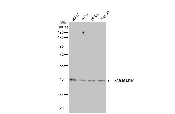 Various whole cell extracts (30 microg) were separated by 10% SDS-PAGE, and the membrane was blotted with p38 MAPK antibody [HL1006] (GTX635797) diluted at 1:1000. The HRP-conjugated anti-rabbit IgG antibody (GTX213110-01) was used to detect the primary antibody.