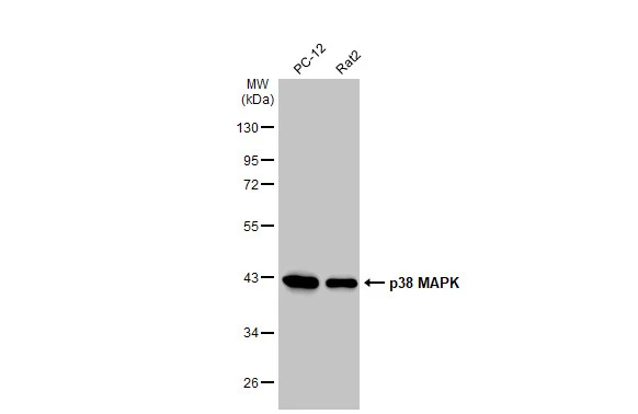 Various whole cell extracts (30 μg) were separated by 10% SDS-PAGE, and the membrane was blotted with p38 MAPK antibody [HL1006] (GTX635797) diluted at 1:1000. The HRP-conjugated anti-rabbit IgG antibody (GTX213110-01) was used to detect the primary antibody.