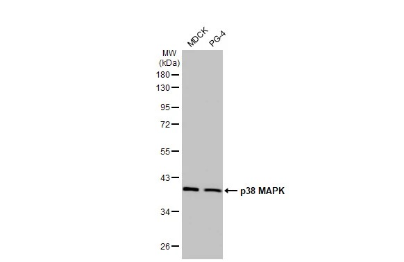 Various whole cell extracts (30 μg) were separated by 10% SDS-PAGE, and the membrane was blotted with p38 MAPK antibody [HL1006] (GTX635797) diluted at 1:1000. The HRP-conjugated anti-rabbit IgG antibody (GTX213110-01) was used to detect the primary antibody.