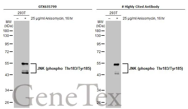 Untreated (–) and treated (+) 293T whole cell extracts (30 μg) were separated by 10% SDS-PAGE, and the membranes were blotted with JNK (phospho Thr183/Tyr185) antibody [HL1008] (GTX635799) diluted at 1:1000 and competitor's antibody diluted at 1:500. The HRP-conjugated anti-rabbit IgG antibody (GTX213110-01) was used to detect the primary antibody. *The competitor is not affiliated with GeneTex and does not endorse this product.