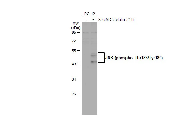 Untreated (–) and treated (+) PC-12 whole cell extract (50 μg) were separated by 10% SDS-PAGE, and the membrane was blotted with JNK (phospho Thr183/Tyr185) antibody [HL1008] (GTX635799) diluted at 1:1000. The HRP-conjugated anti-rabbit IgG antibody (GTX213110-01) was used to detect the primary antibody.