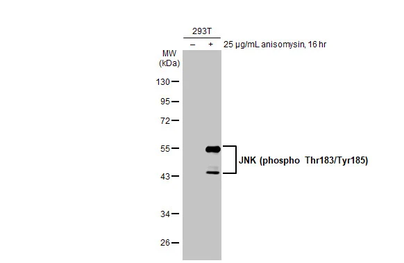 Untreated (–) and treated (+) 293T whole cell extract (30 μg) were separated by 10% SDS-PAGE, and the membrane was blotted with JNK (phospho Thr183/Tyr185) antibody [HL1008] (GTX635799) diluted at 1:1000. The HRP-conjugated anti-rabbit IgG antibody (GTX213110-01) was used to detect the primary antibody.