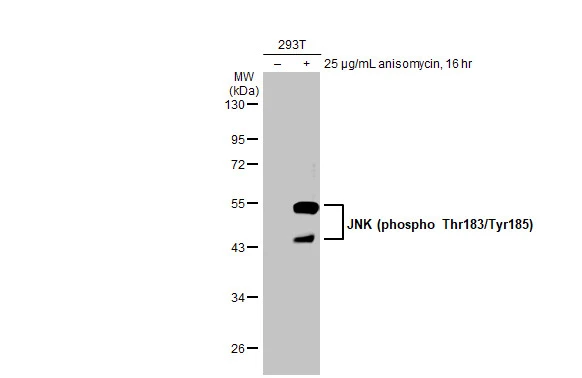 Untreated (–) and treated (+) 293T whole cell extracts (30 μg) were separated by 10% SDS-PAGE, and the membrane was blotted with JNK (phospho Thr183/Tyr185) antibody [HL1008] (GTX635799) diluted at 1:500. The HRP-conjugated anti-rabbit IgG antibody (GTX213110-01) was used to detect the primary antibody.