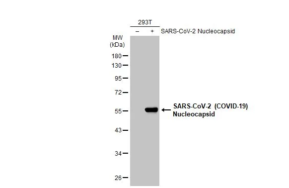 Non-transfected (–) and transfected (+) 293T whole cell extracts (30 μg) were separated by 10% SDS-PAGE, and the membrane was blotted with SARS-CoV-2 (COVID-19) nucleocapsid antibody [GT113] (GTX635808) diluted at 1:5000. The HRP-conjugated anti-mouse IgG antibody (GTX213111-01) was used to detect the primary antibody.
