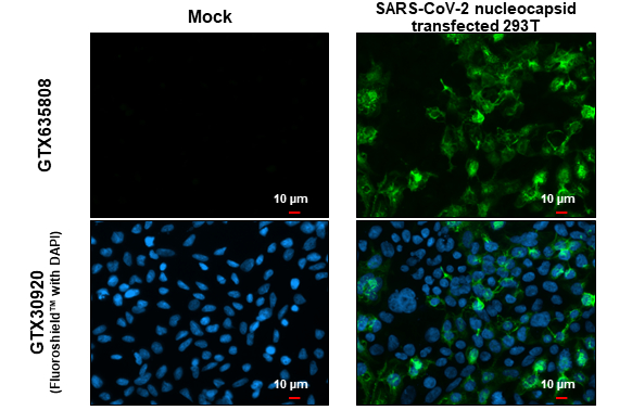 SARS-CoV-2 (COVID-19) nucleocapsid antibody [GT113] detects SARS-CoV-2 (COVID-19) nucleocapsid protein at cytoplasm by immunofluorescent analysis. Sample: Mock and transfected transfected 293T cells were fixed in 4% paraformaldehyde at RT for 15 min. Green: SARS-CoV-2 (COVID-19) nucleocapsid stained by SARS-CoV-2 (COVID-19) nucleocapsid antibody [GT113] (GTX635808) diluted at 1:2000.