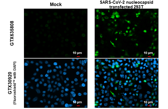 SARS-CoV-2 (COVID-19) nucleocapsid antibody [GT113] detects SARS-CoV-2 (COVID-19) nucleocapsid protein at cytoplasm by immunofluorescent analysis. Sample: Mock and transfected transfected 293T cells were fixed in 4% paraformaldehyde at RT for 15 min. Green: SARS-CoV-2 (COVID-19) nucleocapsid stained by SARS-CoV-2 (COVID-19) nucleocapsid antibody [GT113] (GTX635808) diluted at 1:2000.
