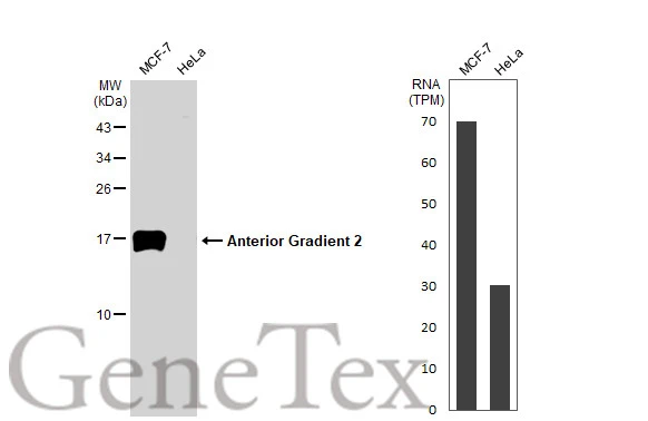 Various whole cell extracts (30 μg) were separated by 15% SDS-PAGE, and the membrane was blotted with Anterior Gradient 2 antibody [HL1024] (GTX635838) diluted at 1:1000. The HRP-conjugated anti-rabbit IgG antibody (GTX213110-01) was used to detect the primary antibody.