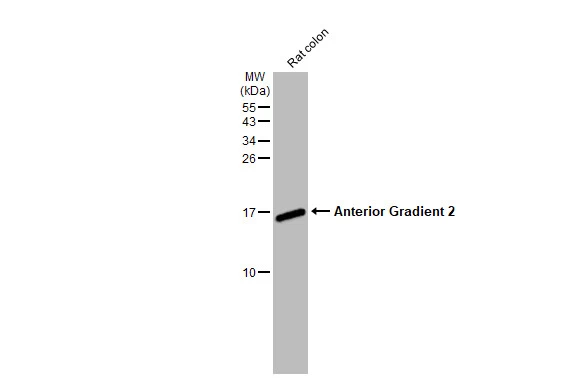 Rat tissue extract (50 μg) was separated by 15% SDS-PAGE, and the membrane was blotted with Anterior Gradient 2 antibody [HL1024] (GTX635838) diluted at 1:1000. The HRP-conjugated anti-rabbit IgG antibody (GTX213110-01) was used to detect the primary antibody.