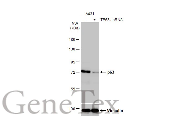 Anti-p63 antibody [HL1027] (GTX635841) | GeneTex