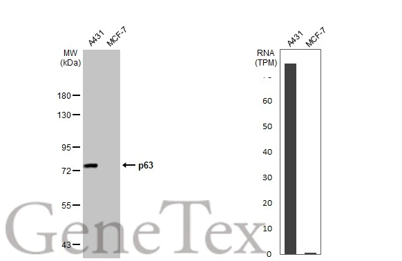 FOTUS フェトウス 蛍光チューブ クローリストバンド Anti-p63 antibody [HL1027] (GTX635841) | GeneTex