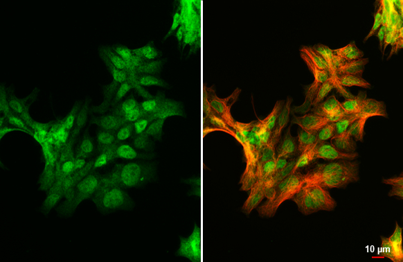Androgen Receptor (ARv7 Splice Variant) antiboy [HL1028] detects Androgen Receptor (ARv7 Splice Variant) protein at nucleus by immunofluorescent analysis. Sample: 22RV1 cells were fixed in 4% paraformaldehyde at RT for 15 min. Green: Androgen Receptor (ARv7 Splice Variant) stained by Androgen Receptor (ARv7 Splice Variant) antiboy [HL1028] (GTX635842) diluted at 1:500. Red: alpha Tubulin, a cytoskeleton marker, stained by alpha Tubulin antibody [GT114] (GTX628802) diluted at 1:1000.