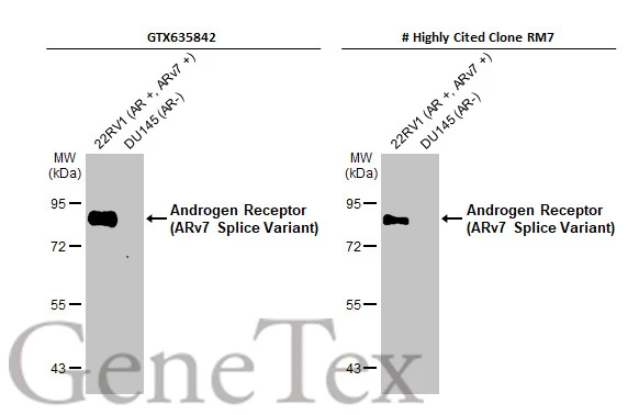 Various whole cell extracts (30 μg) were separated by 7.5% SDS-PAGE, and the membranes were blotted with Androgen Receptor (ARv7 Splice Variant) antiboy [HL1028] (GTX635842) and clone [RM7] diluted at 1:1000. The HRP-conjugated anti-rabbit IgG antibody (GTX213110-01) was used to detect the primary antibody. *The competitor is not affiliated with GeneTex and does not endorse this product.