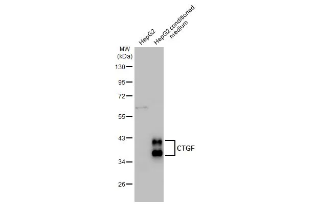 CTGF antibody [GT28711]
