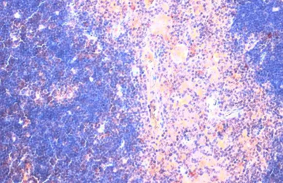 CTGF antibody [GT28711]