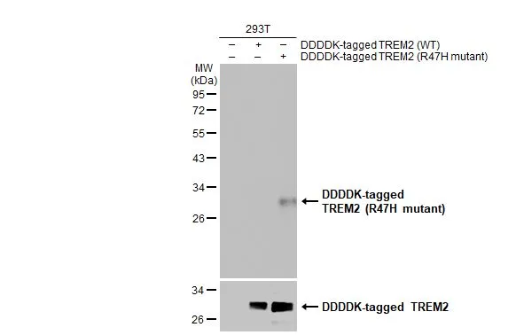 Non-transfected (–) and transfected (+) 293T whole cell extracts (30 μg) were separated by 12% SDS-PAGE, and the membrane was blotted with TREM2 (R47H Mutant) antibody [HL1032] (GTX635872) diluted at 1:5000. The HRP-conjugated anti-rabbit IgG antibody (GTX213110-01) was used to detect the primary antibody.