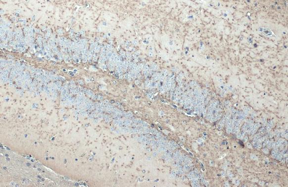 Myelin basic Protein antibody [HL1033] detects Myelin basic Protein protein at cell membrane by immunohistochemical analysis. Sample: Paraffin-embedded mouse brain. Myelin basic Protein stained by Myelin basic Protein antibody [HL1033] (GTX635873) diluted at 1:200. Antigen Retrieval: Citrate buffer, pH 6.0, 15 min