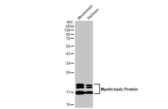 Various tissue extracts (50 μg) were separated by 12% SDS-PAGE, and the membrane was blotted with Myelin basic Protein antibody [HL1033] (GTX635873) diluted at 1:500000. The HRP-conjugated anti-rabbit IgG antibody (GTX213110-01) was used to detect the primary antibody.