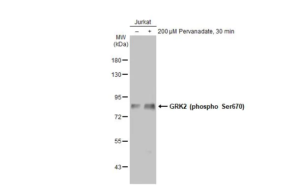 Untreated (–) and treated (+) Jurkat whole cell extracts (30 μg) were separated by 7.5% SDS-PAGE, and the membrane was blotted with GRK2 (phospho Ser670) antibody [HL1035] (GTX635875) diluted at 1:500. The HRP-conjugated anti-rabbit IgG antibody (GTX213110-01) was used to detect the primary antibody.