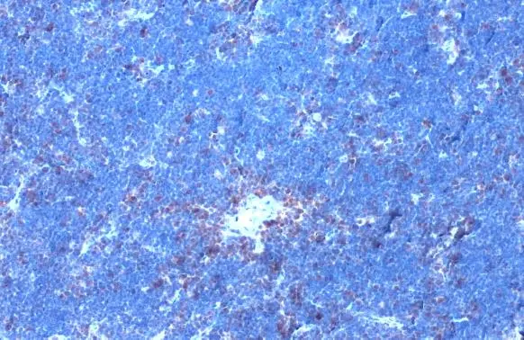 GRK2 (phospho Ser670) antibody [HL1035] detects GRK2 (phospho Ser670) protein at cell membrane and cytoplasm by immunohistochemical analysis. Sample: Paraffin-embedded mouse thymus gland. GRK2 (phospho Ser670) stained by GRK2 (phospho Ser670) antibody [HL1035] (GTX635875) diluted at 1:200. Antigen Retrieval: Citrate buffer, pH 6.0, 15 min