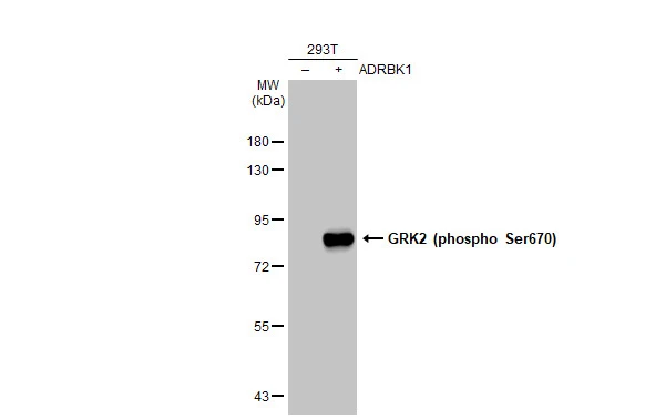 Non-transfected (–) and transfected (+) 293T whole cell extracts (30 μg) were separated by 7.5% SDS-PAGE, and the membrane was blotted with GRK2 (phospho Ser670) antibody [HL1035] (GTX635875) diluted at 1:5000. The HRP-conjugated anti-rabbit IgG antibody (GTX213110-01) was used to detect the primary antibody.