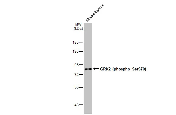 Various tissue extracts (50 μg) was separated by 7.5% SDS-PAGE, and the membrane was blotted with GRK2 (phospho Ser670) antibody [HL1035] (GTX635875) diluted at 1:500. The HRP-conjugated anti-rabbit IgG antibody (GTX213110-01) was used to detect the primary antibody.