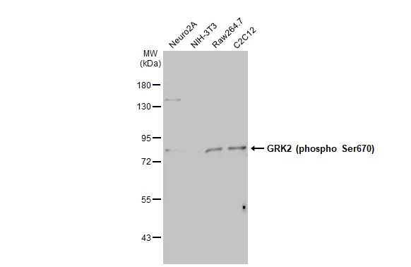 Various whole cell extracts (30 μg) were separated by 7.5% SDS-PAGE, and the membrane was blotted with GRK2 (phospho Ser670) antibody [HL1035] (GTX635875) diluted at 1:500. The HRP-conjugated anti-rabbit IgG antibody (GTX213110-01) was used to detect the primary antibody.